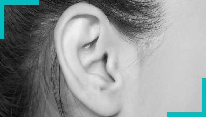 Earfold Oreilles Décollées Lille Dr Elia Earfold Oreilles Décollées Lille Dr Elia